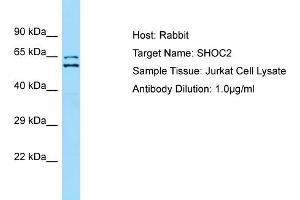Host: RabbitTarget Name: SHOC2Antibody Dilution: 1. (SHoc2/Sur8 Antikörper  (N-Term))