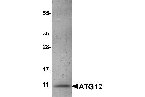 Western Blotting (WB) image for Autophagy Related 12 (ATG12) (AA 101-141) protein (His tag) (ABIN2468250) (ATG12 Protein (AA 101-141) (His tag))