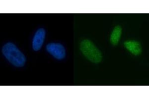 IF analysis of MCM7 using anti-MCM7 antibody (ABIN7601968). (MCM7 Antikörper  (AA 526-719))