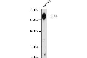 Western Blotting (WB) image for anti-Thrombospondin 1 (THBS1) (AA 80-360) antibody (ABIN3022979)