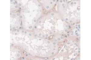 DAB staining on IHC-P; Samples: Human Kidney Tissue. (HPR Antikörper  (AA 70-332))
