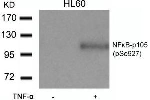 Western blot analysis of extracts from HL60 cells untreated or treated with TNF-a using NFkB-p105(Phospho-Ser927) Antibody. (NFKB1 Antikörper  (pSer927))