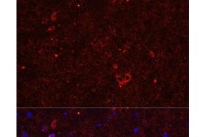 Immunofluorescence analysis of Rat brain using GRIA2 Polyclonal Antibody at dilution of 1:50. (GRIA2 Antikörper)