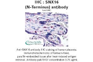 Image no. 2 for anti-Sorting Nexin 16 (SNX16) (N-Term) antibody (ABIN1739488) (SNX16 Antikörper  (N-Term))