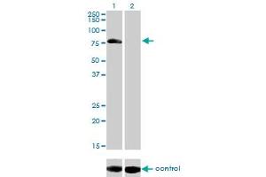 Western blot analysis of AKAP10 over-expressed 293 cell line, cotransfected with AKAP10 Validated Chimera RNAi (Lane 2) or non-transfected control (Lane 1). (AKAP10 Antikörper  (AA 1-100))