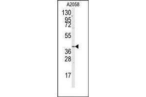 Image no. 1 for anti-Guanine Nucleotide Binding Protein (G Protein) alpha 12 (GNA12) (Ser67) antibody (ABIN360476) (GNA12 Antikörper  (Ser67))