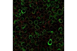Paraformaldehyde-fixed Raji cells stained with Double Stranded DNA Mouse Monoclonal Antibody (121-3)followed by Goat anti-Mouse IgG-CF488 (Green). (dsDNA Antikörper)
