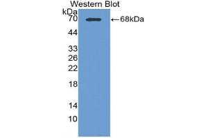 Western blot analysis of the recombinant protein. (CPA3 Antikörper  (AA 110-417))