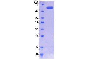 SDS-PAGE analysis of Human COQ6 Protein. (COQ6 Protein)