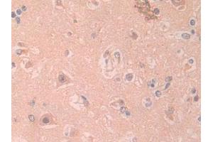 DAB staining on IHC-P; Samples: Human Cerebrum Tissue (IL1RAPL2 Antikörper  (AA 161-330))
