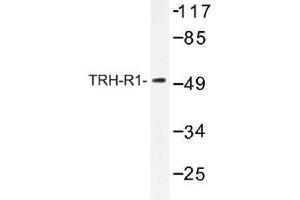 Image no. 1 for anti-Thyrotropin-Releasing Hormone Receptor (TRHR) antibody (ABIN317876) (TRHR Antikörper)