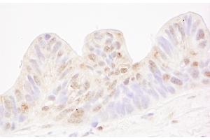 Immunohistochemistry (IHC) image for anti-Methyl-CpG Binding Domain Protein 4 (MBD4) (AA 1-50) antibody (ABIN7448644)