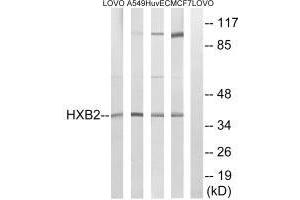 Western blot analysis of extracts from LOVO cells, A549 cells, HUVEC cells and MCF-7 cells, using HOXB2 antibody. (HOXB2 Antikörper)