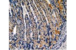 IHC-P analysis of Mouse Stomach Tissue, with DAB staining. (Somatostatin Antikörper  (AA 27-116))