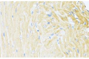Immunohistochemistry of paraffin-embedded Mouse heart using UQCC2 Polyclonal Antibody at dilution of 1:100 (40x lens). (MNF1 Antikörper)