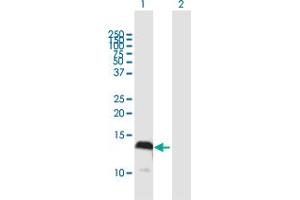 Western Blot analysis of S100A4 expression in transfected 293T cell line by S100A4 MaxPab polyclonal antibody. (s100a4 Antikörper  (AA 1-101))
