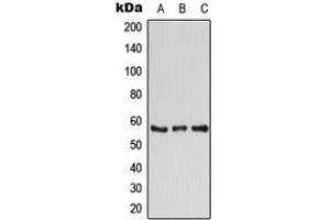 Western Blotting (WB) image for anti-ATPase, H+ Transporting, Lysosomal 56/58kDa, V1 Subunit B1 (ATP6V1B1) (C-Term) antibody (ABIN7294988)