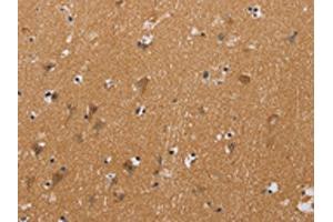 The image on the left is immunohistochemistry of paraffin-embedded Human brain tissue using ABIN7128941(CHRNA4 Antibody) at dilution 1/20, on the right is treated with fusion protein. (CHRNA4 Antikörper)