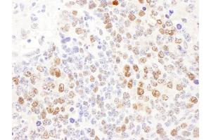Immunohistochemistry (IHC) image for anti-Deoxycytidine Kinase (DCK) (AA 210-260) antibody (ABIN7453430)