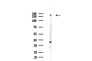 Western blot analysis of lysates from 293 cells(starvation 24h treatment), using THBS1 Antibody at 1/1000 dilution.