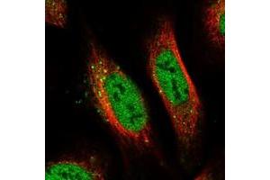 Immunofluorescent staining of human cell line U-2 OS with PRCC polyclonal antibody  at 1-4 ug/mL dilution shows positivity in nucleus but not nucleoli and vesicles. (PRCC Antikörper)
