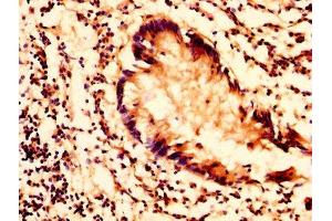 IHC image of ABIN7163362 diluted at 1:200 and staining in paraffin-embedded human appendix tissue performed on a Leica BondTM system.