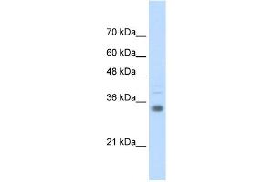 WB Suggested Anti-HOXB4 Antibody Titration:  0. (HOXB4 Antikörper  (C-Term))