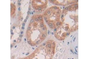 Used in DAB staining on fromalin fixed paraffin- embedded Kidney tissue (PRDM14 Antikörper  (AA 395-568))