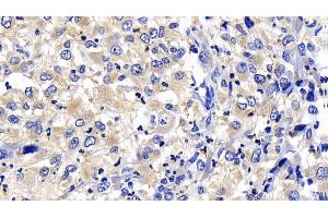 Immunohistochemistry (IHC) image for anti-Caspase 8 (CASP8) (AA 385-479) antibody (ABIN7437074)