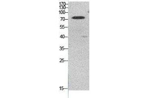Western Blot (WB) analysis of HeLa cells using Acetyl-Ub (K48) Polyclonal Antibody. (Ubiquitin Antikörper  (acLys48))