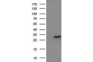 Western Blotting (WB) image for anti-Eukaryotic Translation Initiation Factor 4E Family Member 2 (EIF4E2) antibody (ABIN1497993) (EIF4E2 Antikörper)