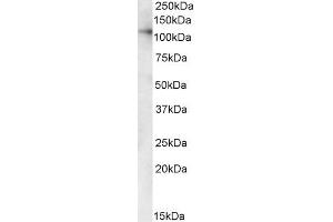 ABIN185504 (1µg/ml) staining of Human Kidney and Liver lysates (35µg protein in RIPA buffer). (USO1 Antikörper  (C-Term))