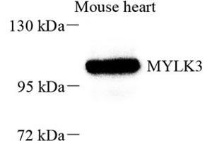 Western blot analysis of MYLK3 (ABIN7074736) at dilution of 1: 800 (MYLK3 Antikörper)