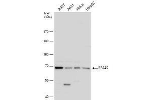 WB Image RPA70 antibody detects RPA70 protein by western blot analysis. (RPA1 Antikörper  (C-Term))