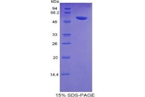SDS-PAGE analysis of Human Glucose Transporter 14 Protein. (SLC2A14 Protein)