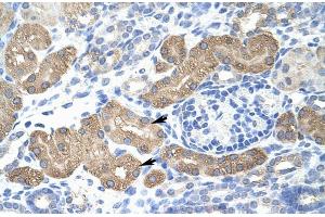Human kidney; Rabbit Anti-L3MBTL2 Antibody. (L3MBTL2 Antikörper  (C-Term))