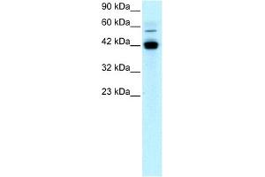 WB Suggested Anti-EGR1 Antibody Titration: 1 ug/ml Positive Control: Jurkat cell lysate (EGR1 Antikörper  (N-Term))