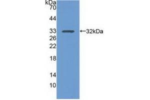 Detection of Recombinant ITGa1, Human using Polyclonal Antibody to Integrin Alpha 1 (ITGa1) (Integrin alpha 1 Antikörper  (AA 125-366))