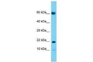 Host: Rabbit Target Name: CNIH2 Sample Type: Placenta lysates Antibody Dilution: 1. (CNIH2 Antikörper  (N-Term))