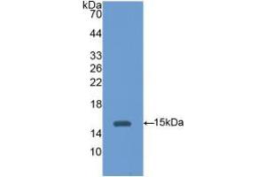 Western blot analysis of recombinant Mouse HEXb. (HEXB Antikörper  (AA 101-217))