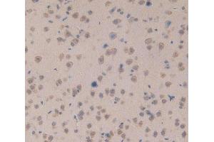 Used in DAB staining on fromalin fixed paraffin- embedded brain tissue (PKC mu Antikörper  (AA 349-612))