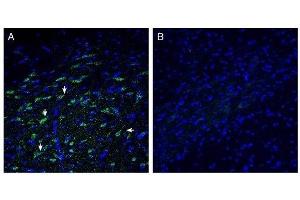 Expression of ZnT10 in rat basal ganglia. (Solute Carrier Family 30, Member 10 (SLC30A10) Peptid)