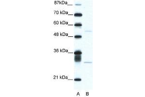 WB Suggested Anti-ATF4  Antibody Titration: 5. (ATF4 Antikörper  (C-Term))