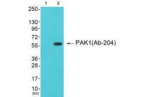 Western blot analysis of extracts from cos-7 cells (Lane 2), using PAK1 (Ab-204) antiobdy. (PAK1 Antikörper  (Ser204))