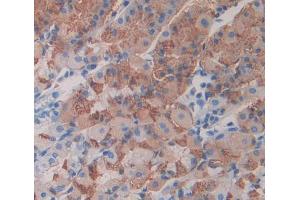 Used in DAB staining on fromalin fixed paraffin- embedded stomach tissue (Neuregulin 2 Antikörper  (AA 618-836))