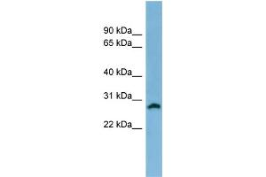 WB Suggested Anti-SRD5A2 Antibody Titration: 0. (SRD5A2 Antikörper  (N-Term))