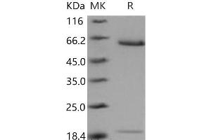 Western Blotting (WB) image for Proprotein Convertase Subtilisin/kexin Type 9 (PCSK9) (Active) protein (His tag) (ABIN7320347) (PCSK9 Protein (His tag))