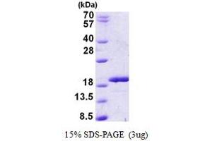 SDS-PAGE (SDS) image for RNA Binding Motif Protein 3 (RBM3) (AA 1-157) protein (His tag) (ABIN5852973)