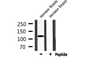 Western blot analysis of extracts from mouse brain, using TRPM8 Antibody. (TRPM8 Antikörper)