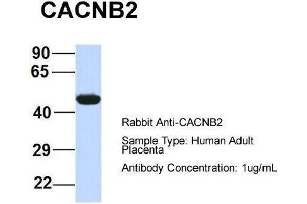 CACNB4 anticorps  (Middle Region)